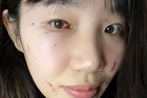 WCBA赛场乱象：外援肘击致毁容，裁判争议不断